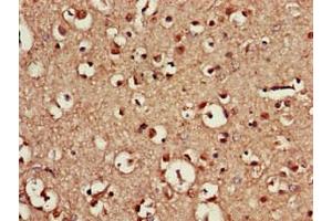 Immunohistochemistry of paraffin-embedded human brain tissue using ABIN7155665 at dilution of 1:100 (CDX4 抗体  (AA 16-174))