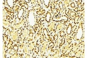 ABIN6275007 at 1/100 staining Mouse kidney tissue by IHC-P. (CLIC4 抗体  (N-Term))