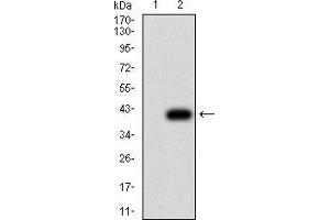 Western Blotting (WB) image for anti-Thrombospondin 1 (THBS1) (AA 750-850) antibody (ABIN5879198) (Thrombospondin 1 抗体  (AA 750-850))