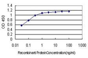 Detection limit for recombinant GST tagged BCL9 is approximately 0. (BCL9 抗体  (AA 1036-1135))