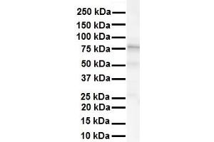 WB Suggested Anti-KCNC3 antibody Titration: 1 ug/mL Sample Type: Human liver (KCNC3 抗体  (Middle Region))