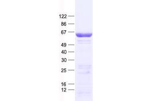 Western Blotting (WB) image for Cell Division Cycle 6 Homolog (S. Cerevisiae) (CDC6) protein (His tag) (ABIN2713848)