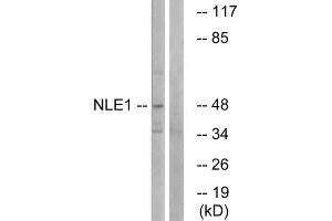 Western blot analysis of extracts from COS cells, using NLE1 antibody. (NLE1 抗体  (Internal Region))