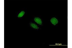 Immunofluorescence of purified MaxPab antibody to BTG4 on HeLa cell. (BTG4 抗体  (AA 1-206))