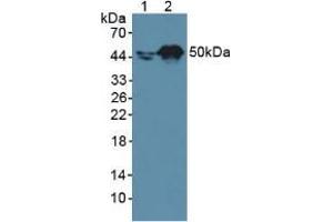 Western blot analysis of (1) Human A431 Cells and (2) Human HepG2 Cells. (Retinoic Acid Receptor alpha 抗体  (AA 237-459))