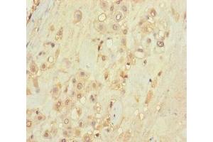 Immunohistochemistry of paraffin-embedded human placenta tissue using ABIN7171488 at dilution of 1:100 (TLN2 抗体  (AA 88-406))
