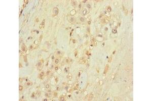 Immunohistochemistry of paraffin-embedded human placenta tissue using ABIN7171488 at dilution of 1:100 (TLN2 抗体  (AA 88-406))