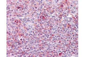 Anti-RELB antibody IHC of human spleen. (RELB 抗体  (N-Term))