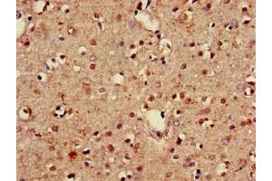 Immunohistochemistry of paraffin-embedded human brain tissue using ABIN7153517 at dilution of 1:100 (GABARAPL1 抗体  (AA 1-117))