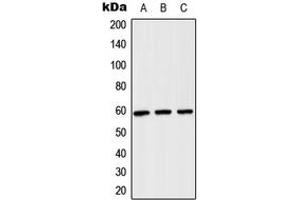 Western blot analysis of TCP1 theta expression in H1299 (A), NIH3T3 (B), PC12 (C) whole cell lysates.