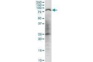 Western Blotting (WB) image for anti-3-phosphoinositide Dependent Protein Kinase-1 (PDPK1) (AA 1-429) antibody (ABIN518765)