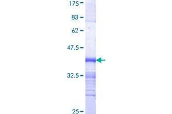 CDK12 Protein (AA 1281-1380) (GST tag)