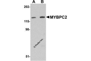 Western Blotting (WB) image for anti-Myosin Binding Protein C, Fast Type (MYBPC2) (C-Term) antibody (ABIN1030525) (MYBPC2 抗体  (C-Term))