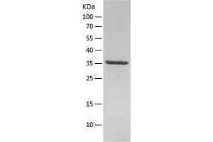 Neurofibromin 1 Protein (NF1) (AA 1-130) (His-IF2DI Tag)