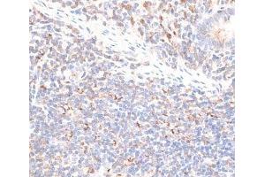 Immunohistochemistry (Paraffin-embedded Sections) (IHC (p)) image for anti-Kinesin Family Member 14 (KIF14) antibody (ABIN7255237)