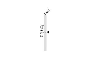 All lanes : Anti-TMEM150B Antibody (N-term) at 1:1000 dilution Lane 1 : Caco2 whole cell lysate Lysates/proteins at 20 μg per lane. (TMEM150B 抗体  (N-Term))