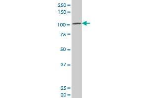 LRP8 polyclonal antibody (A01), Lot # 051007JC01 Western Blot analysis of LRP8 expression in SJCRH30 (LRP8 抗体  (AA 83-170))