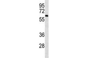 CAMKK2 western blot analysis in mouse cerebellum tissue lysate. (CAMKK2 抗体)