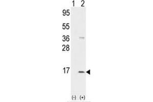 Western blot analysis of PPBP (arrow) using rabbit polyclonal PPBP Antibody (CXCL7 抗体  (N-Term))