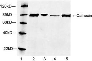 Lane 1: MarkerLane 2: Hela cell lysateLane 3: HEK293 cell lysateLane 4: NIH/3T3 cell lysateLane 5: HepG2 cell lysateWestern blot analysis of cell lysates using 1 µg/mL Rabbit Anti-Calnexin Polyclonal Antibody (ABIN398769) The signal was developed with IRDyeTM 800 Conjugated Goat Anti-Rabbit IgG. (Calnexin 抗体  (C-Term))