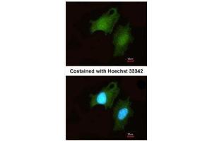 ICC/IF Image Immunofluorescence analysis of methanol-fixed HeLa, using DIP2B, antibody at 1:200 dilution. (DIP2B 抗体  (C-Term))