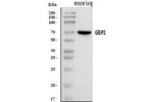 Western blot analysis of Gbp2 using anti-Gbp2 antibody (ABIN7600364).