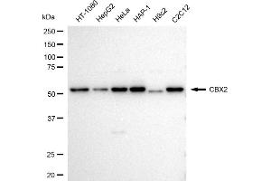 Western blotting analysis using CBX2 antibody (ABIN7798062).