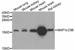 Western blot analysis of extracts of various cell lines, using MAP1LC3B antibody (ABIN4904290) at 1:1000 dilution.