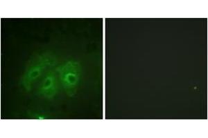 Immunofluorescence analysis of HeLa cells, using p47 phox (Phospho-Ser359) Antibody. (NCF1 抗体  (pSer359))