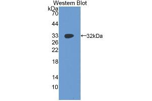 Western blot analysis of the recombinant protein. (IGF2BP2 抗体  (AA 141-384))
