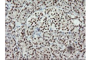 Image no. 2 for anti-Malignant T Cell Amplified Sequence 1 (MCTS1) (AA 1-181) antibody (ABIN1490599) (MCTS1 抗体  (AA 1-181))