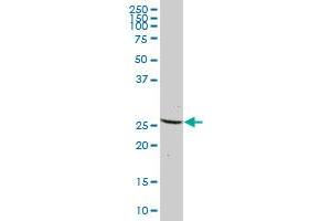 DCTN6 MaxPab polyclonal antibody. (DCTN6 抗体  (AA 1-190))
