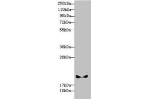 Western blot All lanes: BLOC1S6 antibody at 3. (Pallidin 抗体  (AA 1-170))
