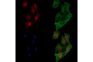 ABIN6265199 and ABIN6273321 staining  cells by IF/ICC.