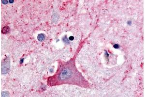 Human Brain, Neuron (formalin-fixed, paraffin-embedded) stained with TRHR antibody ABIN213340 at 20 ug/ml followed by biotinylated goat anti-rabbit IgG secondary antibody ABIN481713, alkaline phosphatase-streptavidin and chromogen. (TRHR 抗体  (C-Term))
