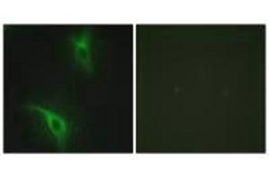 Immunofluorescence analysis of HeLa cells, using CKS1 antibody. (CKS1 抗体  (N-Term))