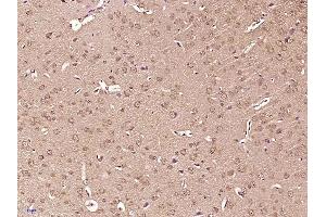 Paraformaldehyde-fixed, paraffin embedded mouse brain, Antigen retrieval by boiling in sodium citrate buffer (pH6) for 15min, Block endogenous peroxidase by 3% hydrogen peroxide for 30 minutes, Blocking buffer (normal goat serum) at 37°C for 20min, Antibody incubation with Tuberin (Thr927) Polyclonal Antibody  at 1:400 overnight at 4°C, followed by a conjugated secondary and DAB staining. (Tuberin 抗体  (pThr927))