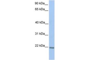 Western Blotting (WB) image for anti-Zinc Finger Protein 548 (ZNF548) antibody (ABIN2461998) (ZNF548 抗体)