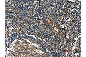 The image on the left is immunohistochemistry of paraffin-embedded Human tonsil tissue using ABIN7190849(GPR182 Antibody) at dilution 1/30, on the right is treated with synthetic peptide. (G Protein-Coupled Receptor 182 抗体)