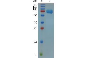 SDS-PAGE (SDS) image for Tumor-Associated Calcium Signal Transducer 2 (TACSTD2) (AA 25-270) protein (Fc Tag) (ABIN7092858)