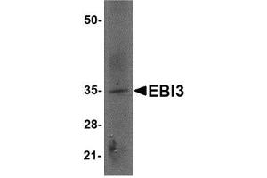 Western blot analysis of EBI3 in rat spleen tissue lysate with AP30307PU-N EBI3 antibody at 2 μg/ml. (EBI3 抗体  (Center))