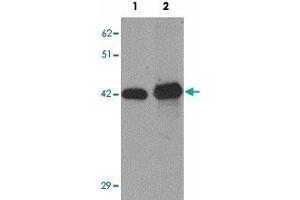 Western blot analysis of SLC39A12 in HepG2 cell lysate with SLC39A12 polyclonal antibody  at (1) 0.