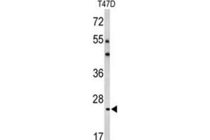 Western Blotting (WB) image for anti-BCL2-Related Protein A1 (BCL2A1) antibody (ABIN2997079) (BCL2A1 抗体)
