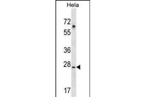 SRPK1 Antibody (M1) (ABIN391794 and ABIN2841649) western blot analysis in Hela cell line lysates (35 μg/lane). (SRPK1 抗体  (N-Term))