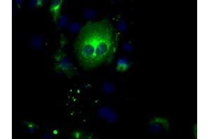 Image no. 3 for anti-Nucleotide Exchange Factor SIL1 (SIL1) antibody (ABIN1496809) (SIL1 抗体)