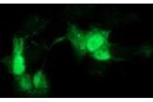 Anti-GCKR mouse monoclonal antibody (ABIN2454032) immunofluorescent staining of COS7 cells transiently transfected by pCMV6-ENTRY GCKR (RC214230). (GCKR 抗体)