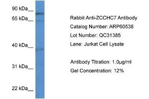 WB Suggested Anti-ZCCHC7  Antibody Titration: 0. (ZCCHC7 抗体  (C-Term))
