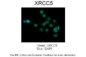 Sample Type :  Human lung adenocarcinoma cell line A549  Primary Antibody Dilution :  1:100  Secondary Antibody :  Goat anti-rabbit AlexaFluor 488  Secondary Antibody Dilution :  1:400  Color/Signal Descriptions :  XRCC5: Green DAPI:Blue  Gene Name :  XRCC5   Submitted by :  Dr.
