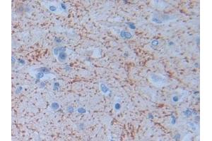 Immunohistochemistry (IHC) image for anti-Protease, serine, 2 (Trypsin 2) (PRSS2) (AA 24-241) antibody (ABIN7433747)