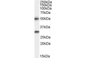 Western Blotting (WB) image for anti-Transmembrane Protease, serine 5 (TMPRSS5) (C-Term) antibody (ABIN2466316) (TMPRSS5 抗体  (C-Term))